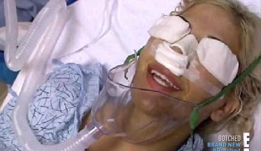 بالصور : امرأة تجري 13 عملية جراحية لتشبه إيفانكا ترامب!!