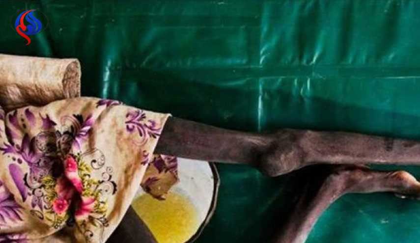 الكوليرا تحصد 14 شخصا في شمال شرق نيجيريا