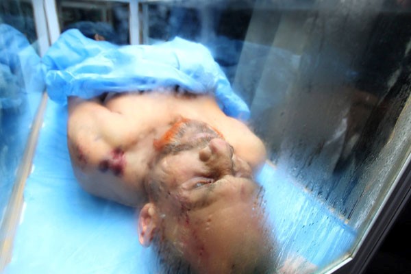 تحویل جسد معاون صدام به وزارت بهداشت عراق + عکس
