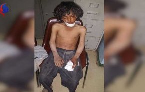 تبعات دردناک انفجار بمب خوشه ای بر کودکان یمن