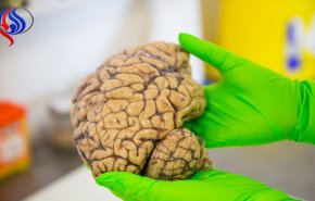 یافته جدید محققان برای کند کردن پیری مغز