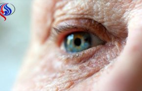تشخیص آلزایمر 20 سال قبل ازبروز با آزمایش چشم
