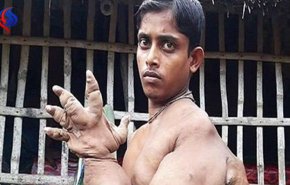 دست اسرارآمیز نوجوان بنگلادشی+تصاویر