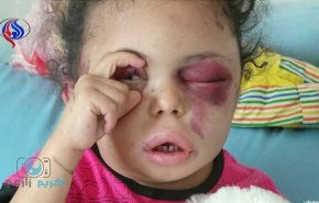 تصاویر کودکی که اعضای خانواده اش قربانی بمباران سعودی ها شدند