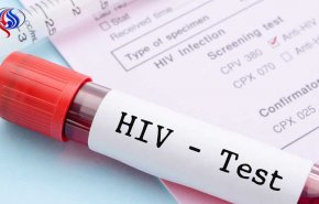 آزمایش ایدز پیش از ازدواج اجباری شود