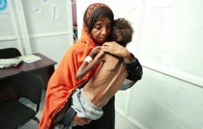 وضع فاجعه‌بار انسانی، مردم یمن را به زانو درآورده است