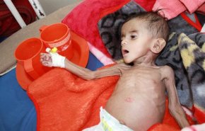 یمن از گرسنگی در حال مرگ است