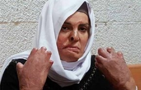بی‌اعتنایی اسرائیل به زن اسیر فلسطینی با 50 درصد سوختگی