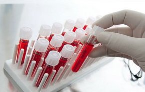 ردیابی ۸ نوع سرطان با آزمایش خون ممکن شد