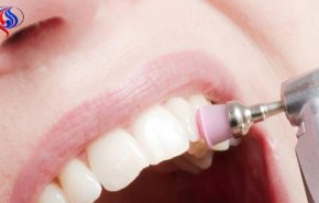 طريقة فعالة جداً لازالة الجير عن الأسنان في دقيقتين!