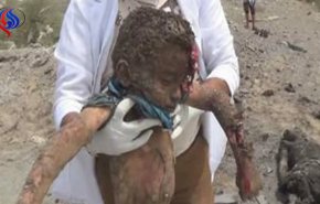 بالفيديو...اليونيسف: الهجوم على النازحين بالحديدة أكثر الهجمات دموية على الأطفال