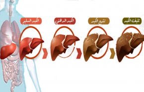 أعراض مرض الكبد وتأكيد امتلاء الكبد بالسموم!