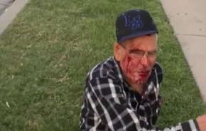 حمله نژادپرستانه با آجر به پیرمرد ۹۲ ساله در لس آنجلس + عکس