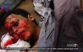 أطفال اليمن.. ضحايا توحش المحمدين