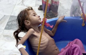 أنقذوا اليمن من المجاعة.. أسوأ كارثة انسانية سببها العدوان