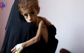 اظهارات تکان‌دهنده معاون دبیرکل سازمان ملل درباره «گرسنگی» میلیون‌ها یمنی