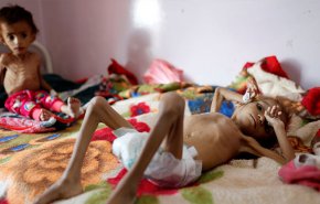  في اليمن ... صرخة الطفولة مذبوحة بين اضراس المجاعة !