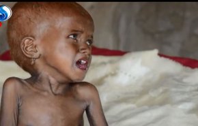 سازمان های بین المللی نسبت به گرسنگی در یمن هشدار دادند