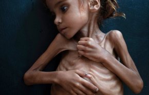 التايمز تختار صورة طفلة يمنية ضمن أهم 10 صور للعام 2018
