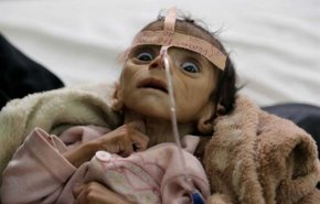 الأمم المتحدة: 10 ملايين يمني يعانون من الجوع الشديد