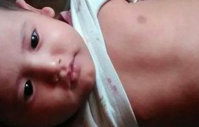 کشتار کودکان یمنی با شیوع وبا  