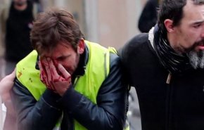 نماد تازه اعتراضات فرانسه؛ معترضانی که چشم خود را از دست داده‌اند