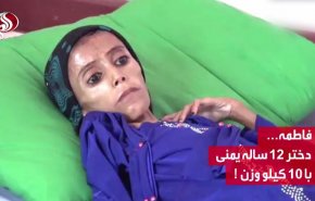 ویدئوگرافیک/ دختر 12 ساله یمنی با 10 کیلو وزن!