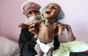 مئات اليمنيين في الدريهمي يصارعون الموت.. والسبب؟