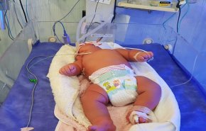 ولادة اثقل طفل في ايران بزنة 5.8 كغم