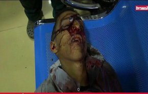 ارتفاع عدد ضحايا مجزرة جديدة في صنعاء الى 13 شهيدا و90 جريحاً 