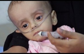 الصحة اليمنية: عدم توفر دعامات قلبية وصمامات لأكثر من 60 ألف مريض