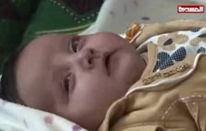 مرگ نوزادهای یمنی در پی جنایات سعودی؛ بمب‌های خوشه‌ای و گازهای سمی هنوز قربانی می گیرند