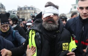 دستکم ۲۴ معترض فرانسوی از ناحیه چشم آسیب دیده‌اند