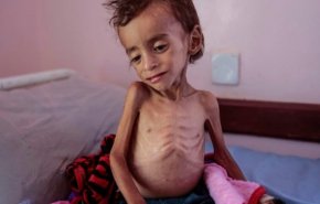 سازمان بهداشت جهانی: 35 هزار یمنی مبتلا به سرطان، با خطر مرگ رو به‌رو هستند