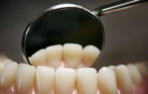 8 نصائح ذهبية لتحمي أسنانك من التسوس 