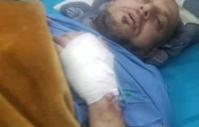 أمين عام العاصمة صنعاء يتعرض لمحاولة اغتيال فاشلة