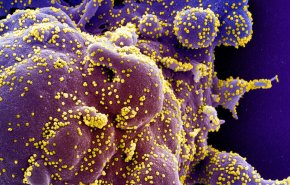 حصيلة إصابات فيروس كورونا بالعالم تتجاوز 1.5 مليون