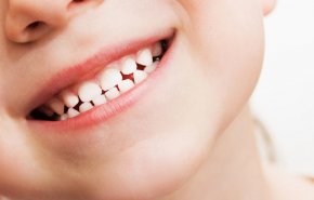 نصائح هامة للحفاظ على صحة أسنان ولثة طفلك