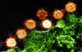 دراسة تكشف قدرة خاصة لدى فيروس كورونا مكّنته من إصابة البشر