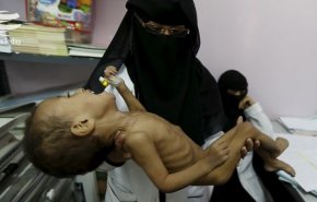 سازمان ملل: ۲۰ میلیون یمنی با گرسنگی و کرونا روبرو هستند