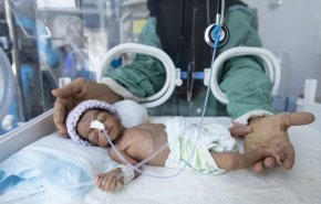 شاهد.. قرار سعودي سيحول المستشفيات اليمنية الی مقابر