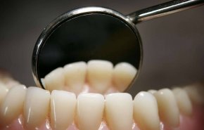 طرق سهلة وسحرية للحصول على أسنان ناصعة البياض