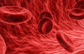ما علاقة الأواني الحديدية بفقر الدم؟
