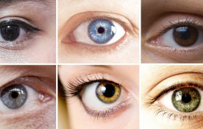 سبب اختلاف لون العيون واللون الأكثر شيوعا في العالم