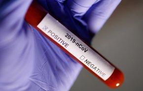 أكثر من 27 مليون إصابة بعدوى الفيروس التاجي في العالم