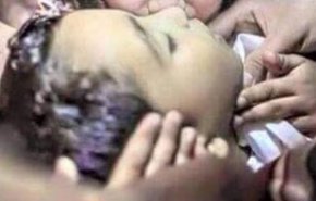 کشته و مجروحیت بیش از 13 هزار زن و کودک یمنی در پی حملات ائتلاف سعودی