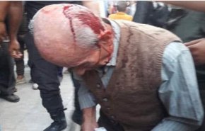 سوريا.. ما قصة الرجل المسن الذي ضرب على رأسه أمام الفرن بحلب