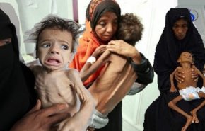 شاهد: اليمن على شفير أسوأ كارثة انسانية في العالم  