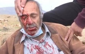 إصابة مسن ونجله إثر اعتداء المستوطنين على مزارعين شرق نابلس