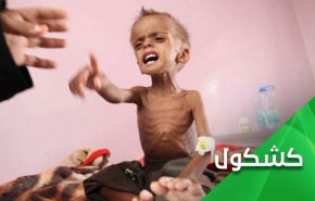 گرسنگی؛ آخرین سلاح شکست خوردگان در یمن...